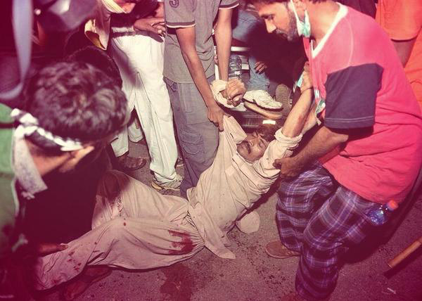 An Injured person being carried to a Hospital for treatment